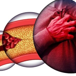 kolesterol dusman mi denge mi 3k2MExMY