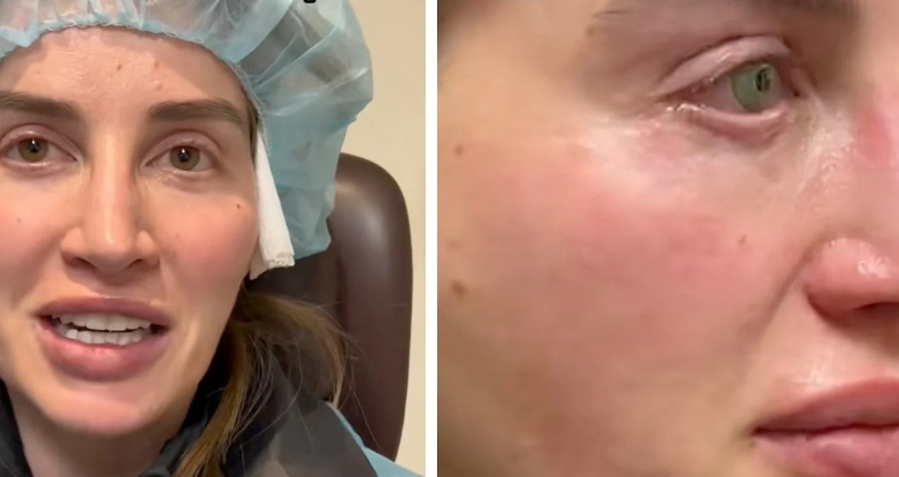 9 milyon kisi bu gozleri konusuyor kalici olarak yaptirdi gorenler dondu kaldi 6lSgfxaa