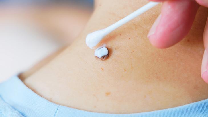 lazer de yaptiran da var solusyon suren de her ben masum degil incelenmeli M8EFOsy4.jpg